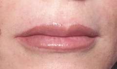 Maquillage permanent des lèvres à Aix-en-Provence Venelles dermopigmentation de la bouche